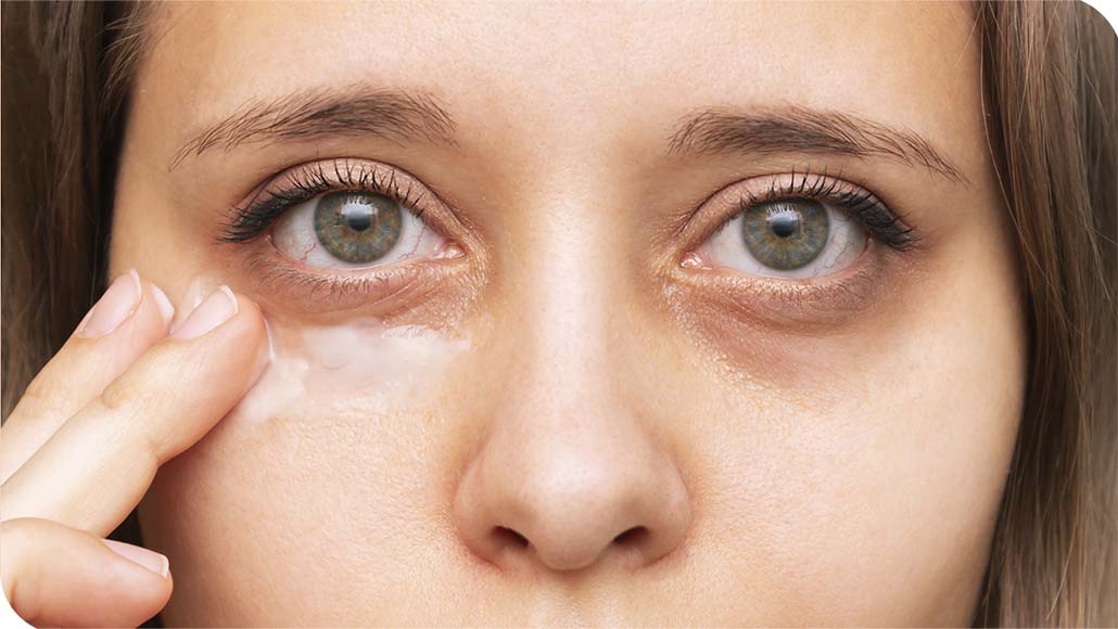 mulher aplicando um creme em suas olheiras