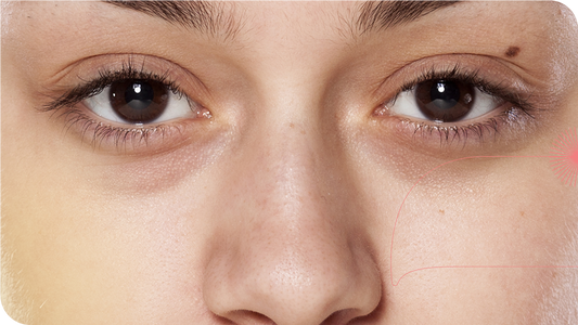 Close na região dos olhos de uma mulher com olheiras